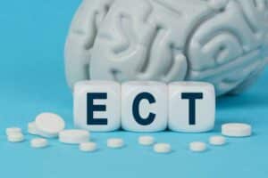 electroconvulsive therapy vs tms