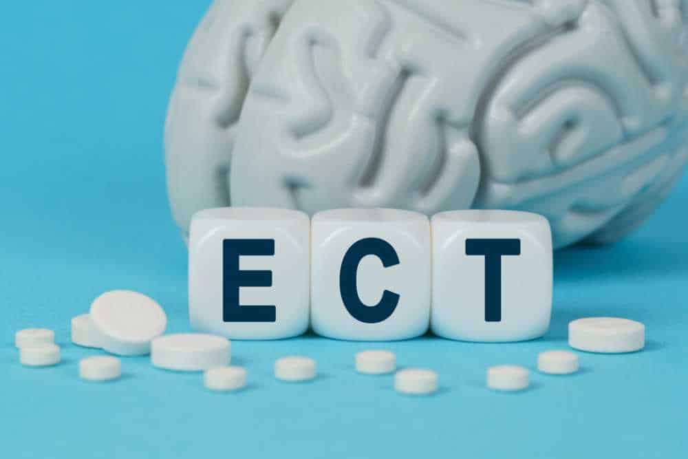 electroconvulsive therapy vs tms