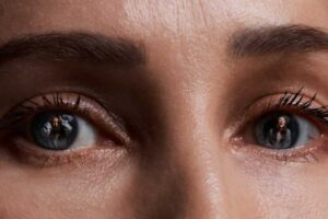 outpatient bipolar treatment